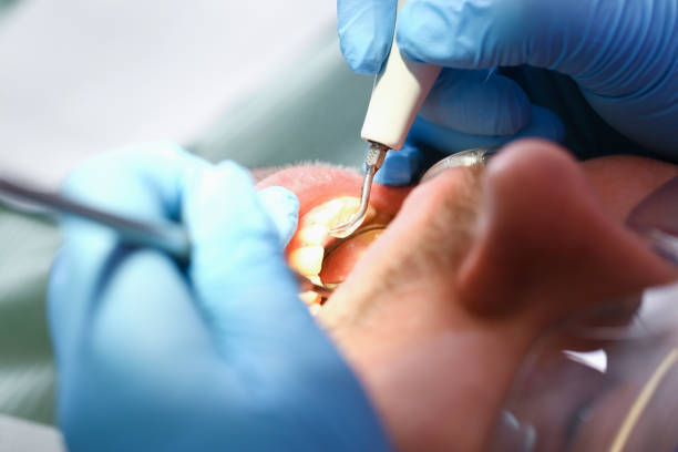 Best Emergency Dental Care for Trauma or Injury in Innotion, VA